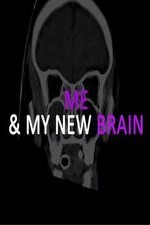 Me & My New Brain