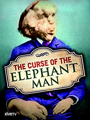 Curse Of The Elephant Man